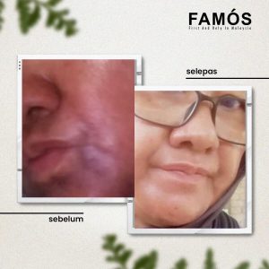 testimoni 1